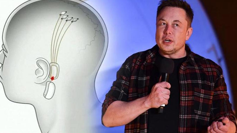 Elon Musk - Neurolink
